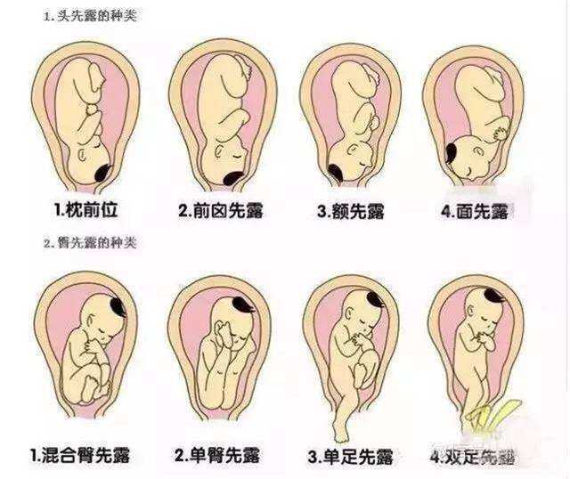 江苏高龄女性代孕食物,北京北医三院供卵中心什么条件才能登记排队