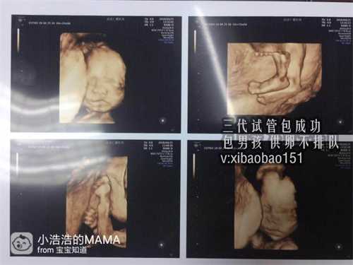 深圳高龄供卵代怀,引起妊娠生化的原因有很多